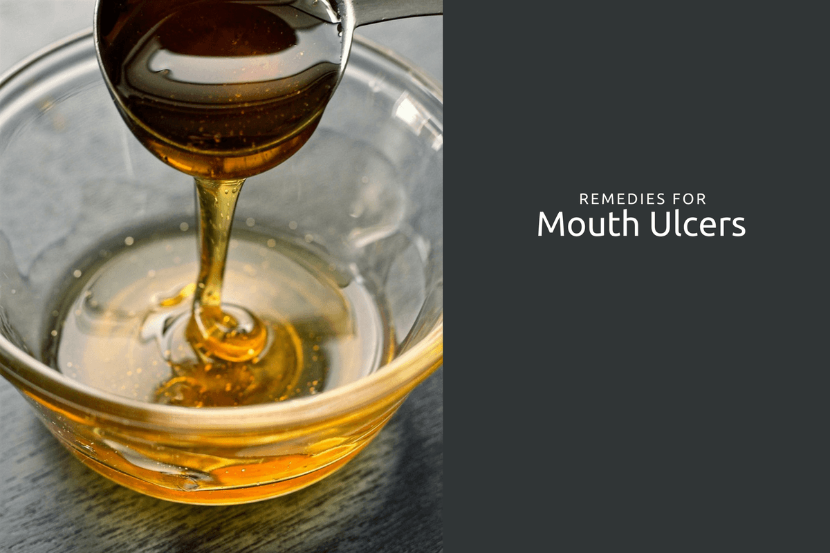 Treatment of Mouth Ulcers in Ayurveda Ayurvedum