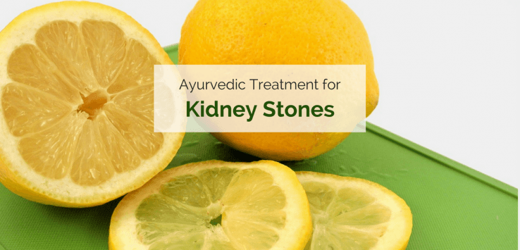 Ayurvedic treatment for kidney stones