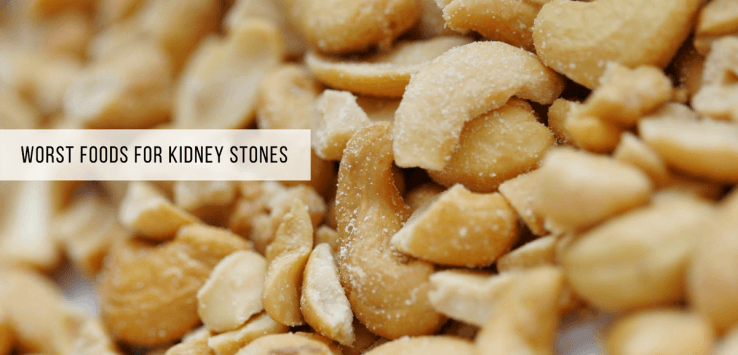 foods to avoid for kidney stones