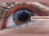 cataract treatment in ayurveda