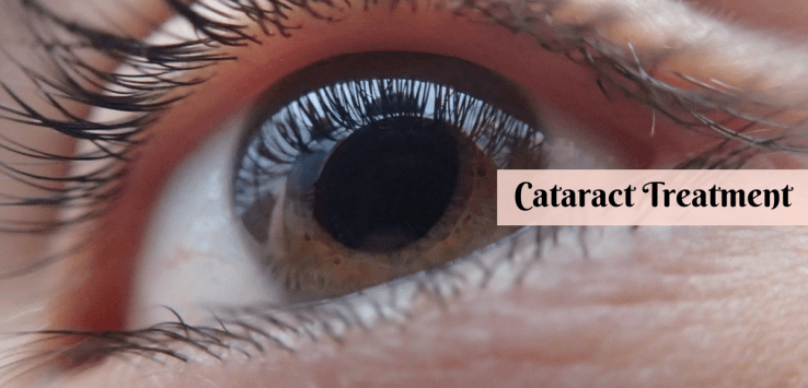 cataract treatment in ayurveda
