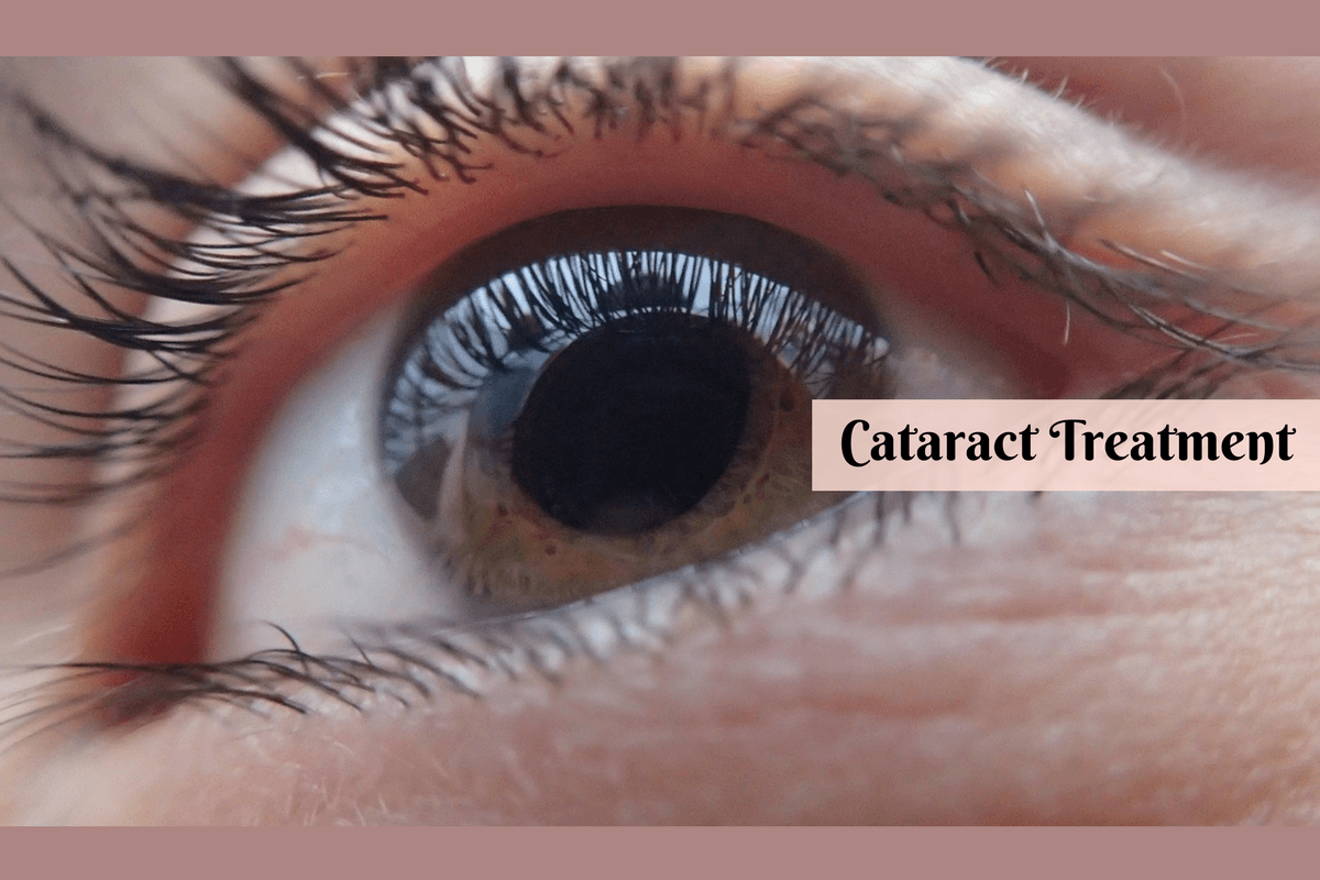 Here's A Cataract Treatment In Ayurveda Without Surgery