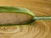 Home Remedies For Ringworm