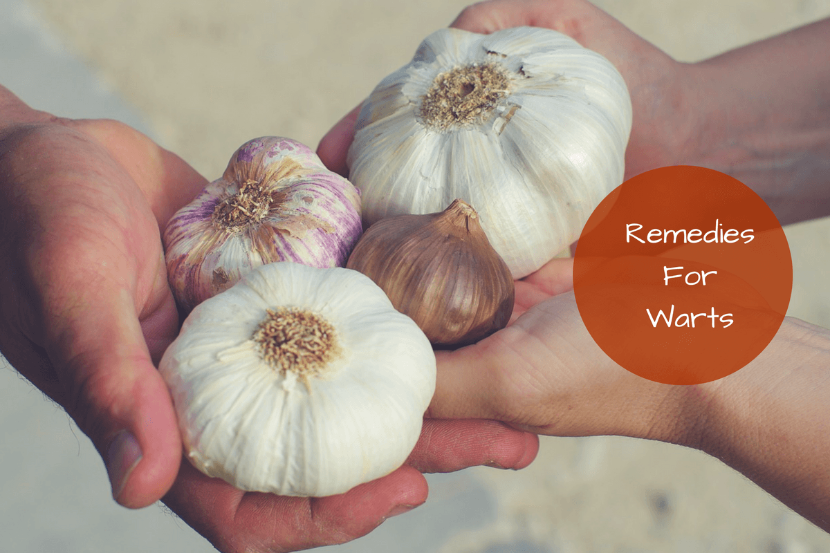 7 Natural Home Remedies For Warts Painless, Easy and Ayurvedic