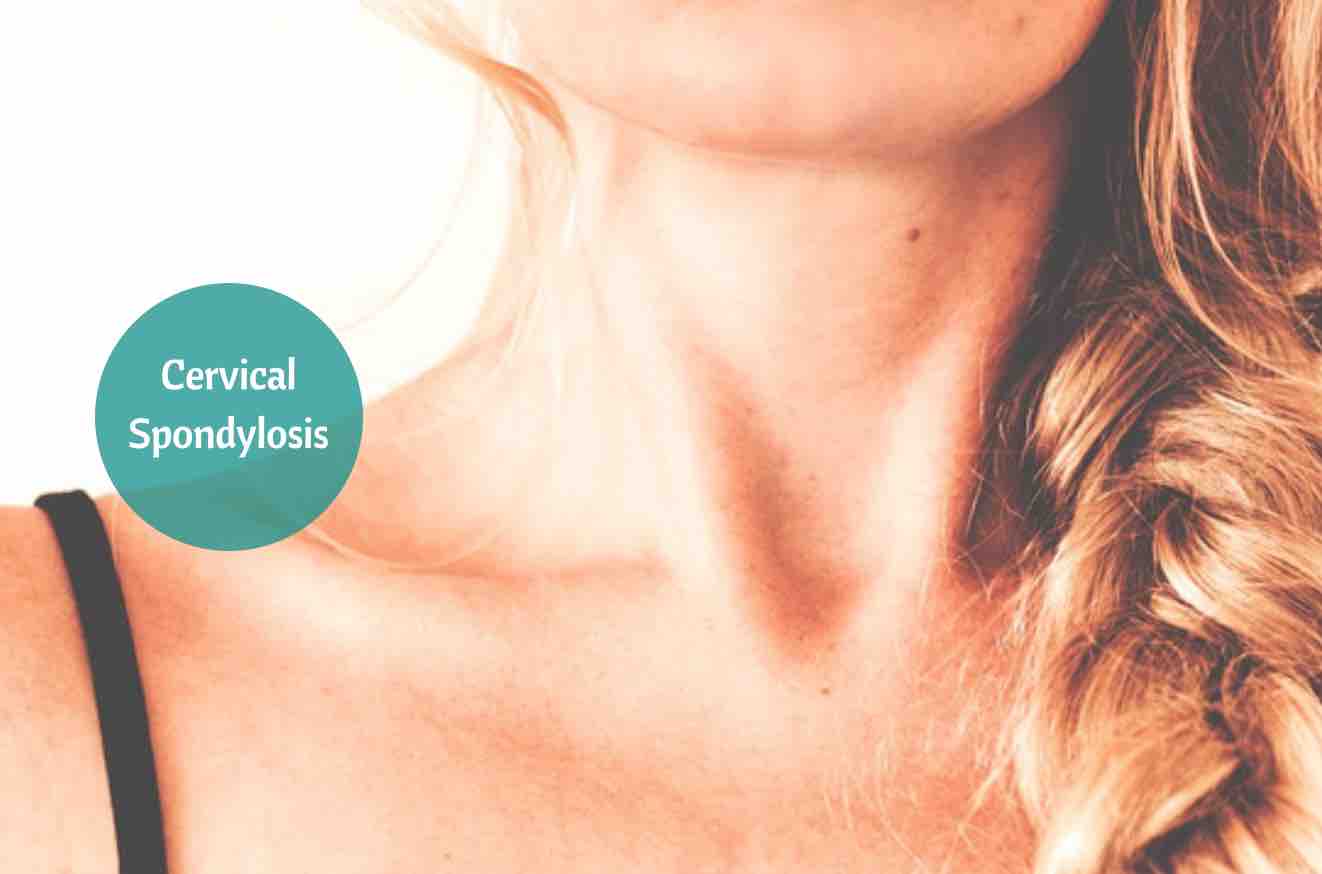 Cervical Spondylosis Symptoms And Home Remedies To Treat Them
