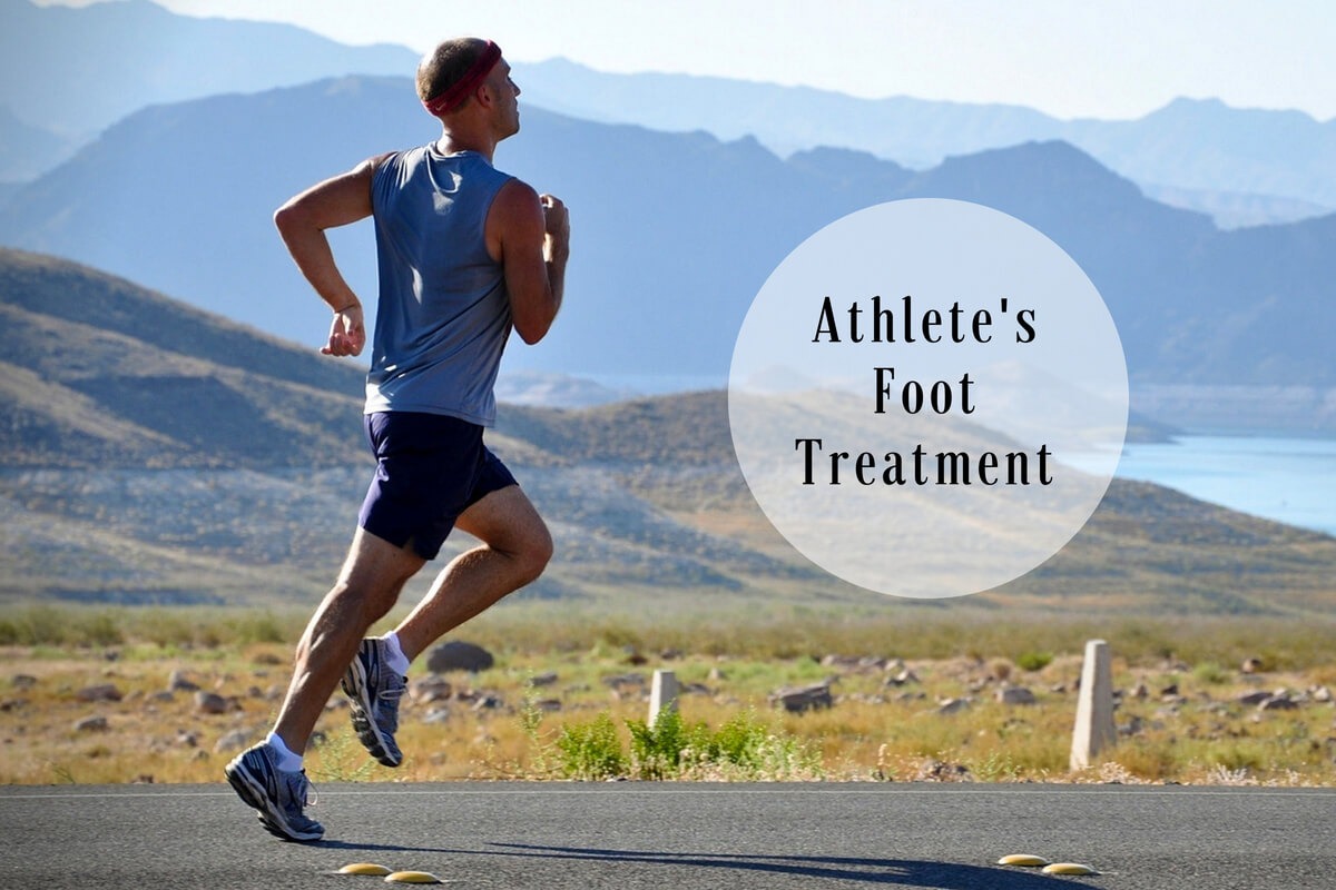 Athlete's Foot Treatment Essential Home Remedies