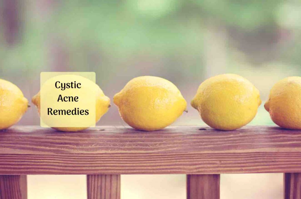 cystic acne treatment Ayurvedum