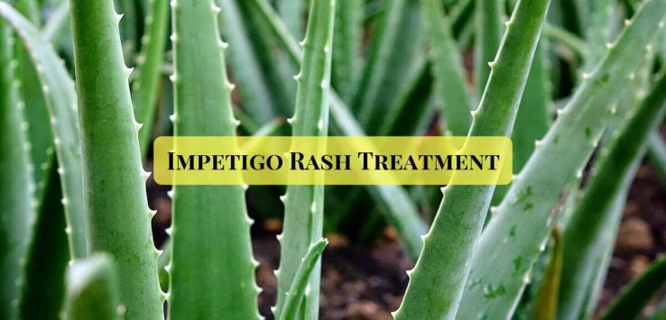 Impetigo treatment _ Ayurvedum