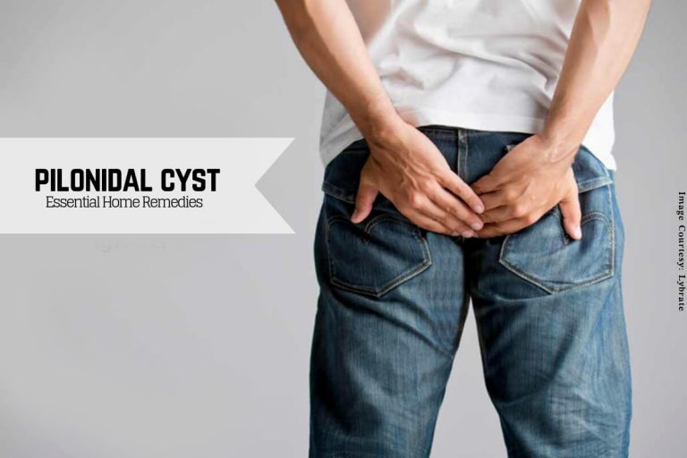 Pilonidal cyst _ Ayurvedum Ayurvedum