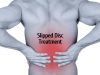 Slipped Disc treatment _ Ayurvedum (1)