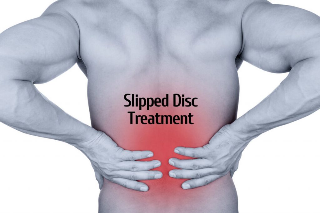 Slipped Disc treatment _ Ayurvedum (1) Ayurvedum