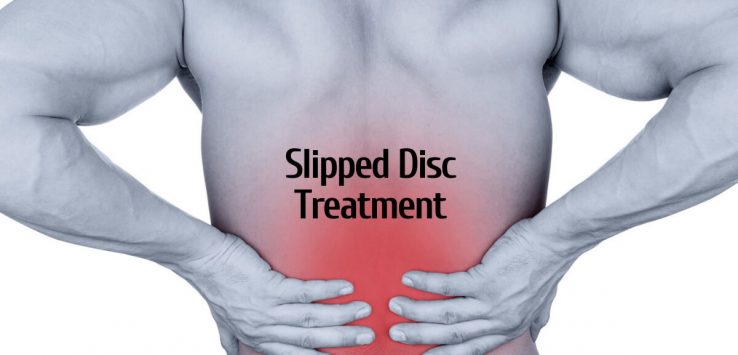 Slipped Disc treatment _ Ayurvedum (1)