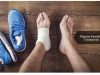 plantar fasciitis _ Ayurvedum