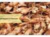 Huntington's Disease _ Ayurvedum