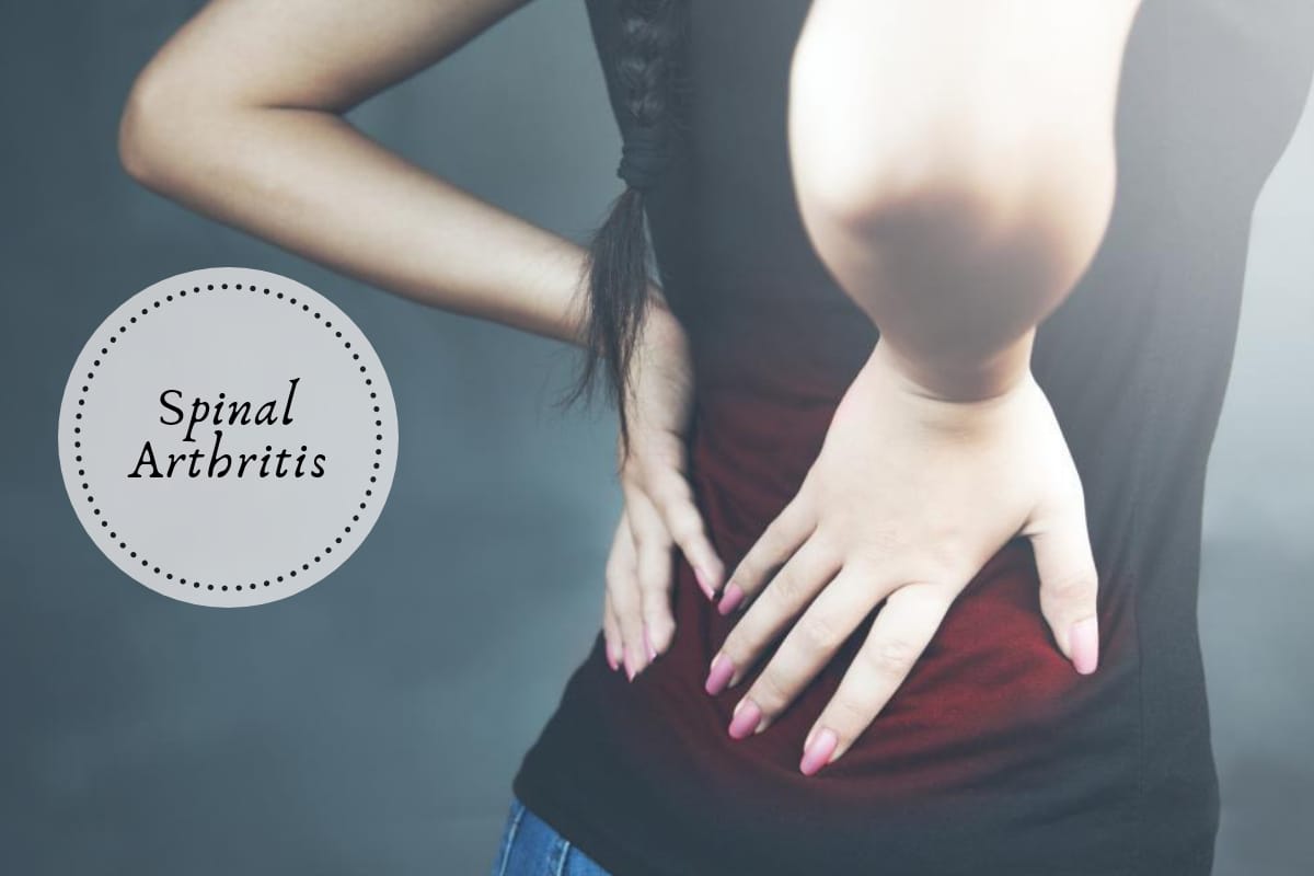 Spinal Arthritis 7 Herbal Remedies To Take Care Of Your Lower Back