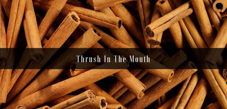 thrush in the mouth _ Ayurvedum