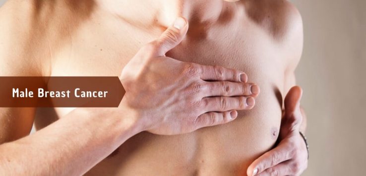 male breast cancer _ Ayurvedum