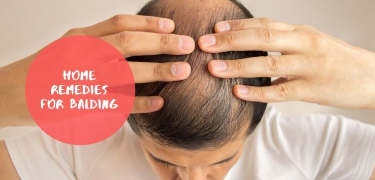 Balding Treatment _ Ayurvedum